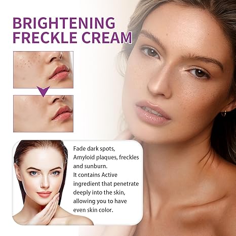 Spot Fading Urea ,Dark Spot Reducing,𝐖𝐡𝐢𝐭𝐞𝐧𝐢𝐧𝐠 and 𝐅𝐫𝐞𝐜𝐤𝐥𝐞 Removal Cream