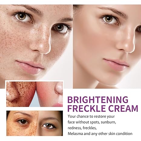 Spot Fading Urea ,Dark Spot Reducing,𝐖𝐡𝐢𝐭𝐞𝐧𝐢𝐧𝐠 and 𝐅𝐫𝐞𝐜𝐤𝐥𝐞 Removal Cream