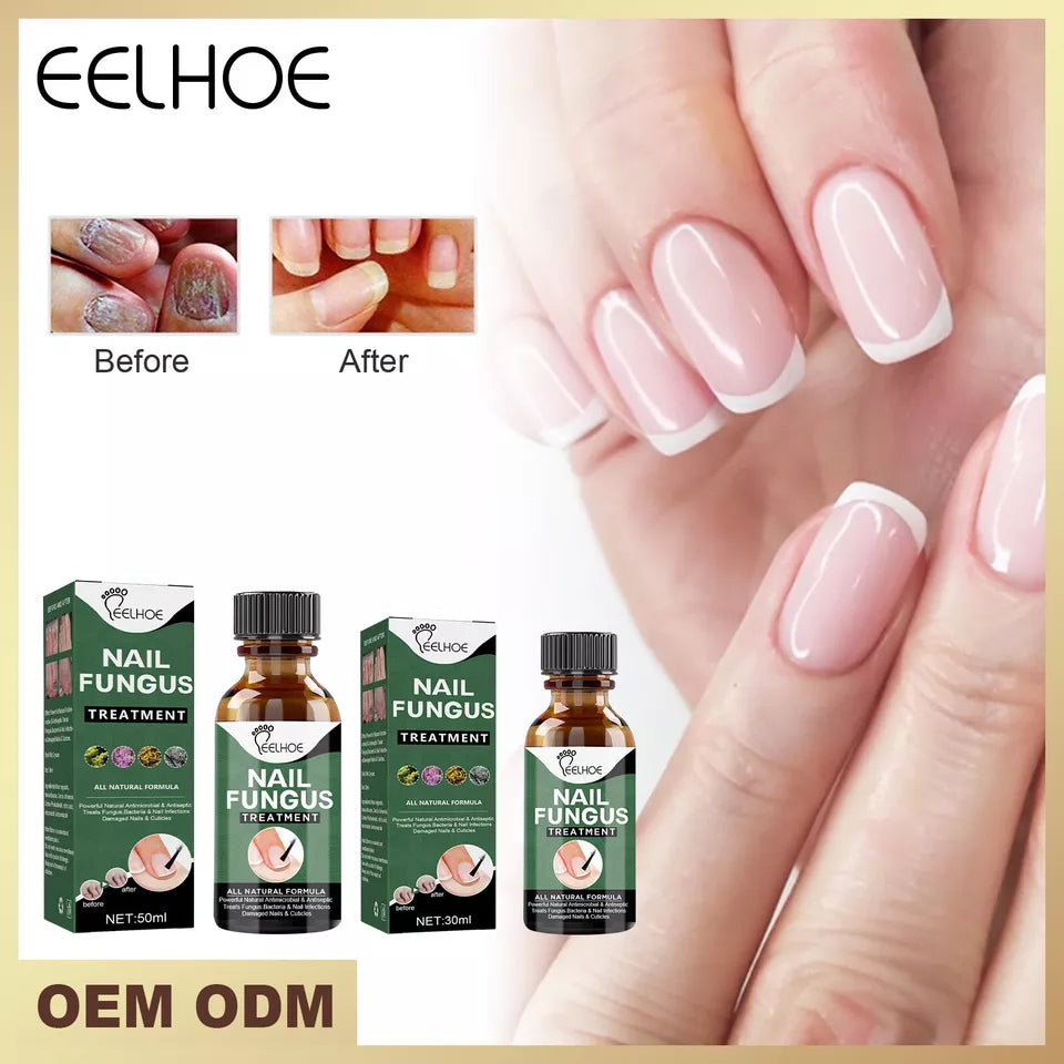 Fast Nail Fungal Treatments Nail Repair Essences Serum